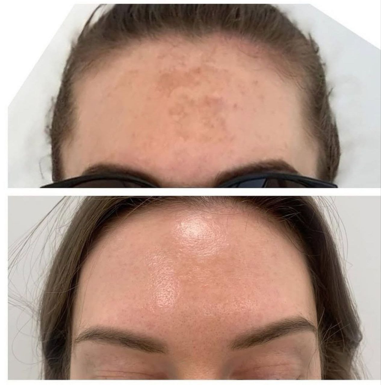 Пример практического применения авторского Skin Brightening — Фото № 6