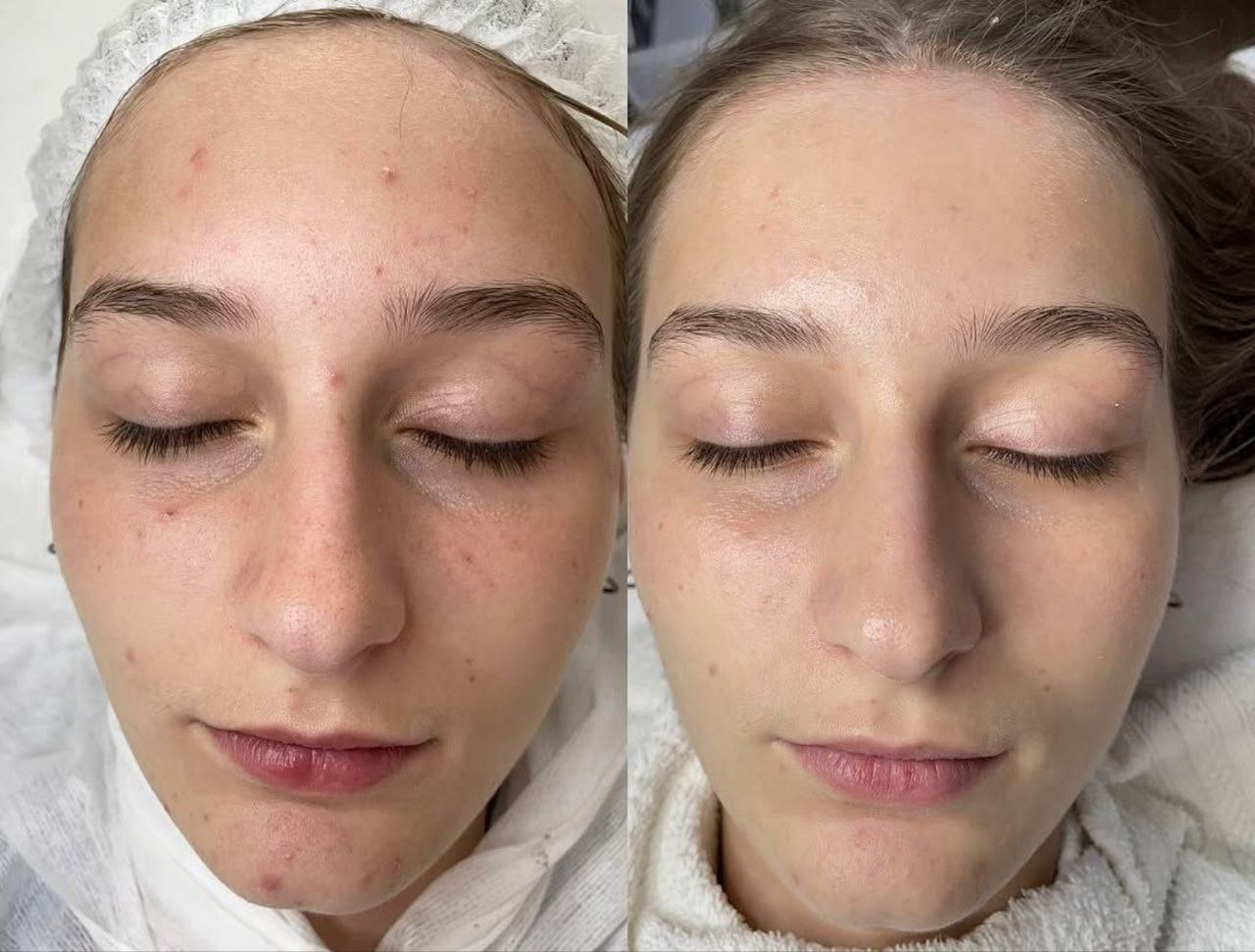 Пример практического применения авторского Skin Brightening — Фото № 8